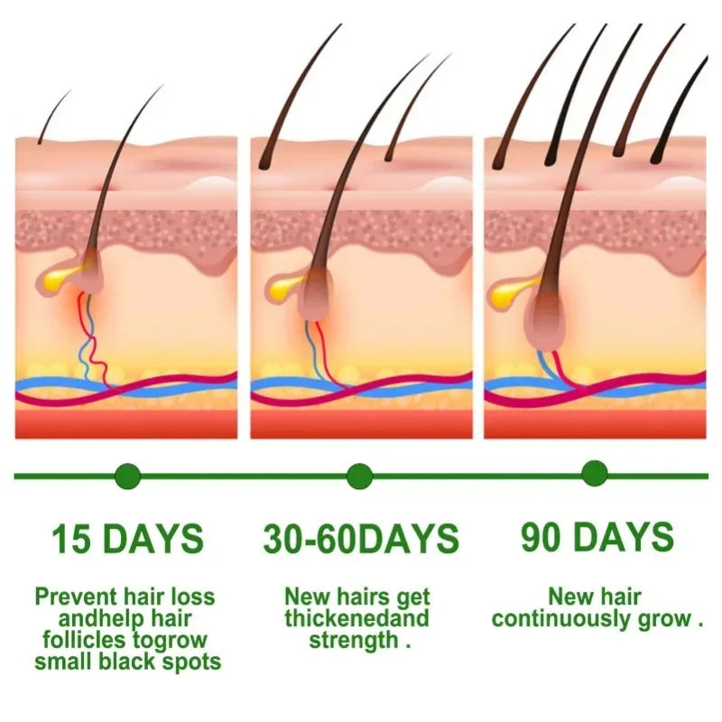 Hair Growth Serum Fast Growing Hair Care Set Essential Oil Dense Regrowth Rosemary Hair Promoting Regeneration for Women Men